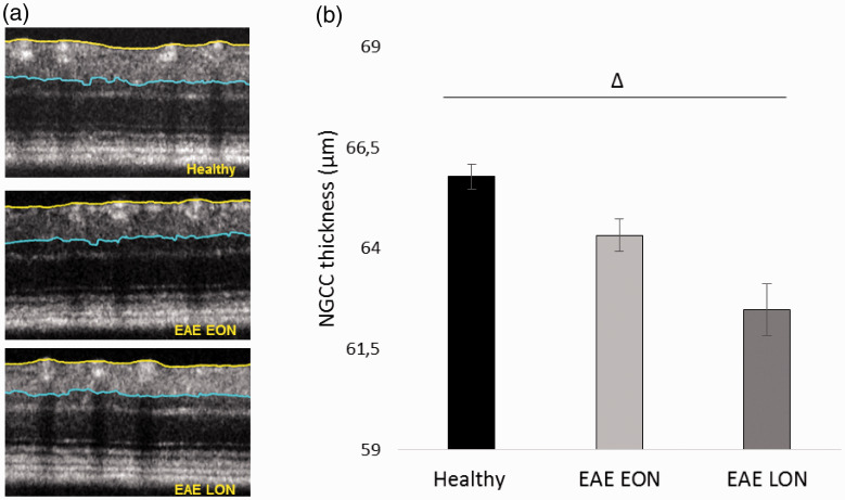 Figure 14.