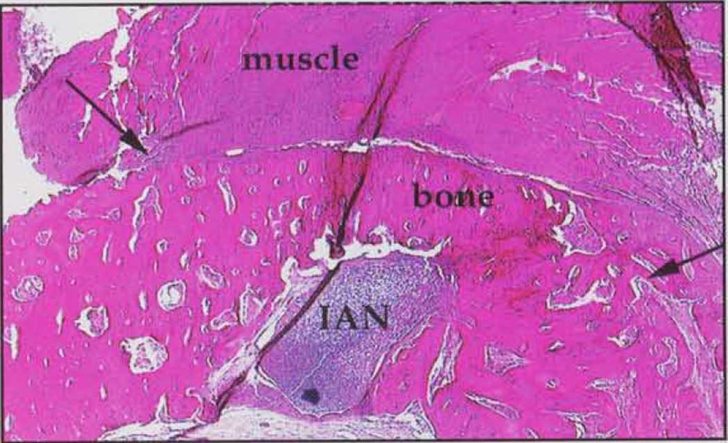 Figure (b)