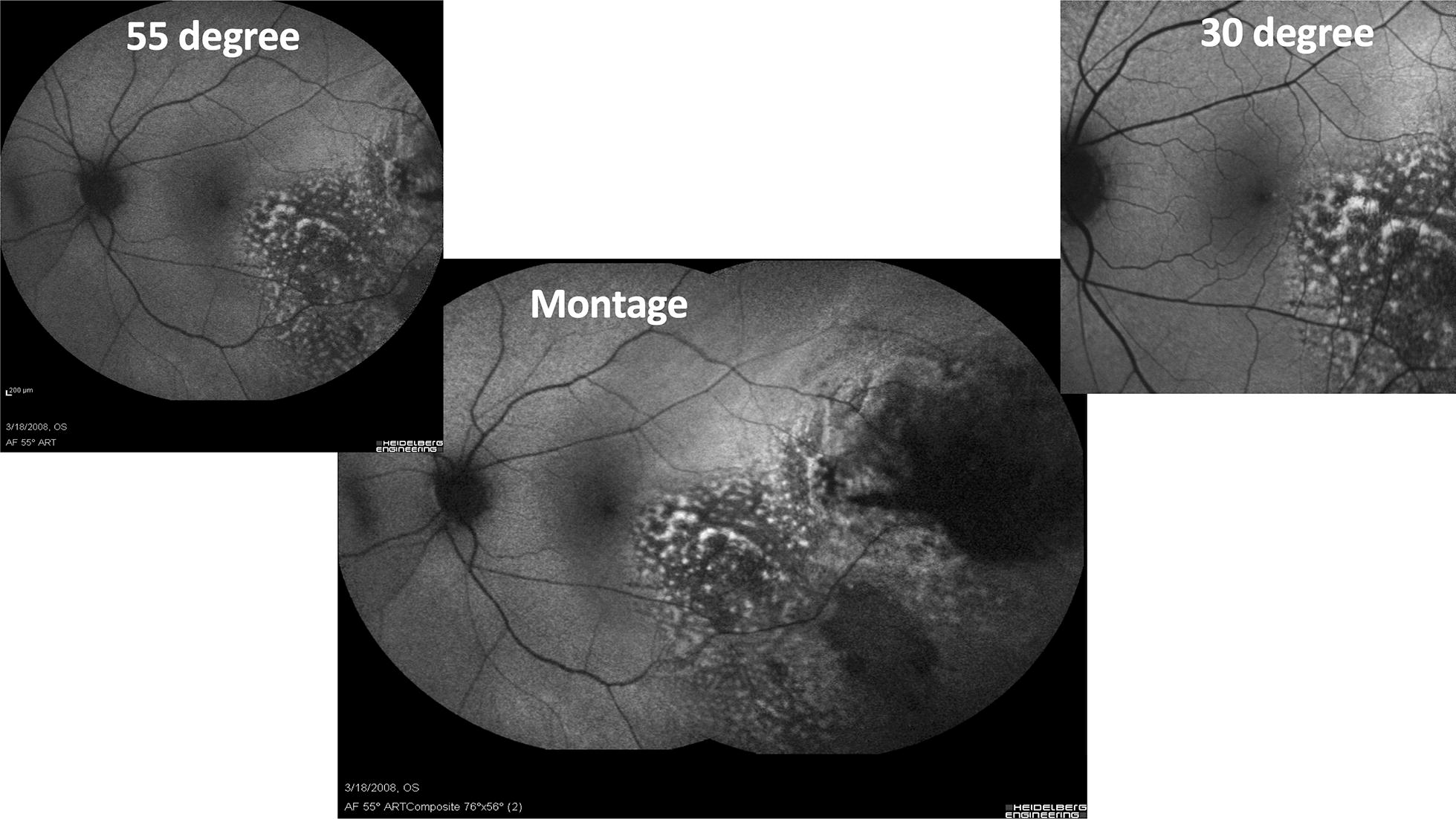 Fig. 2