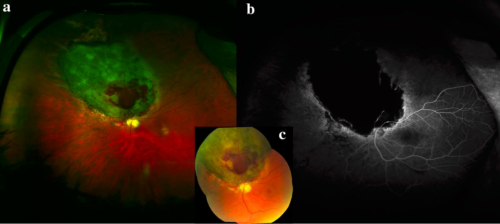 Fig. 9