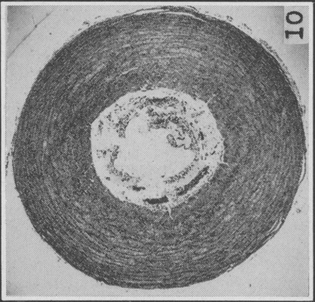 Fig. 10