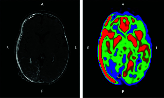 FIG 1.