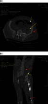 Figure 3