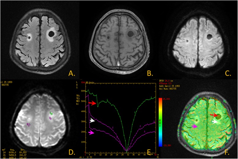 Fig. 2