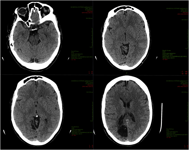 Fig. 5