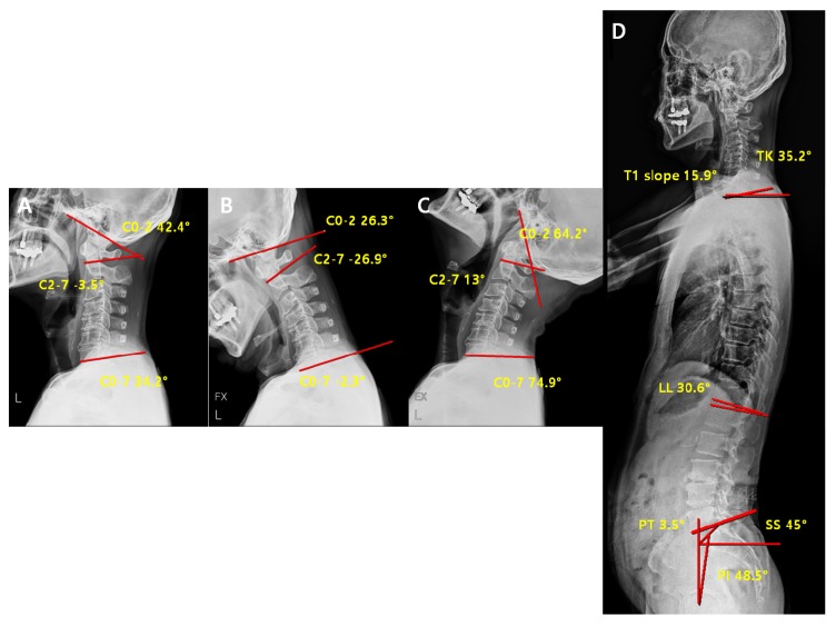 Figure 11