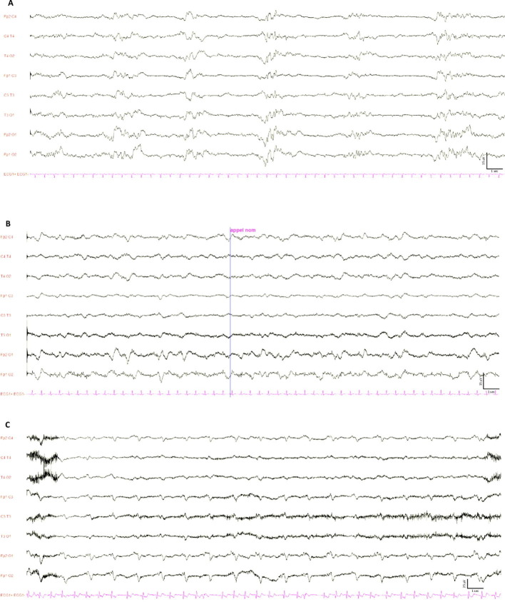 Supplementary figure 1