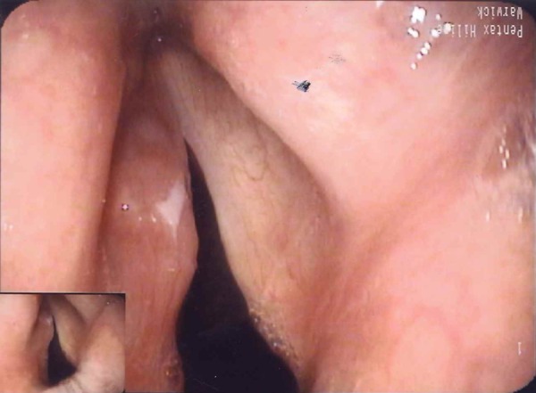 Figure 2