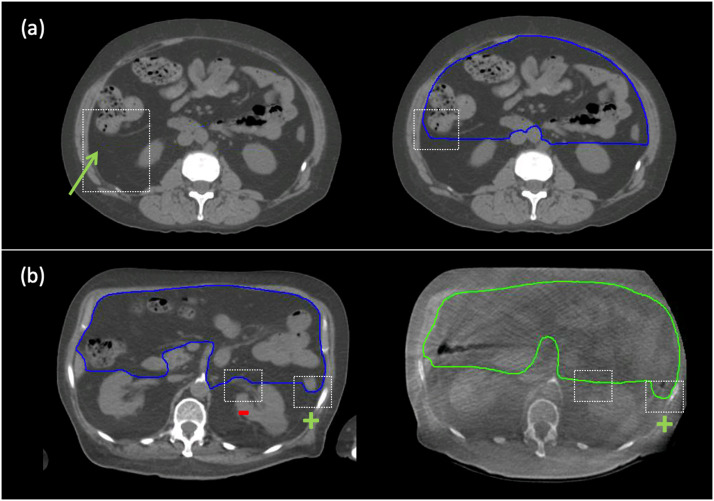 Fig 4