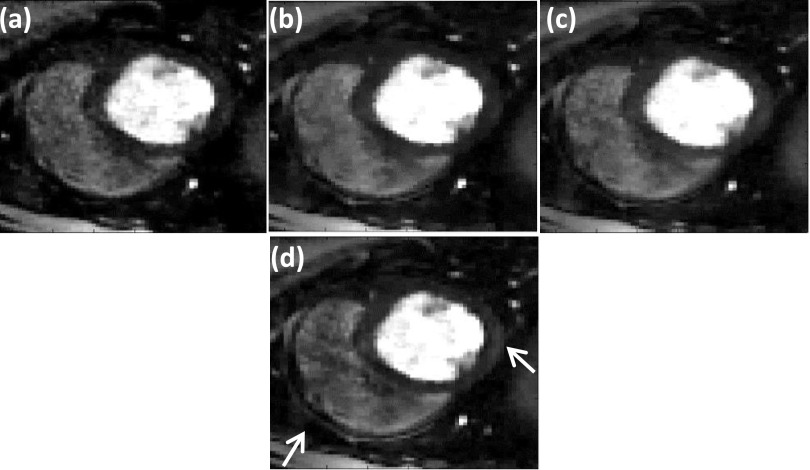 FIG. 10.