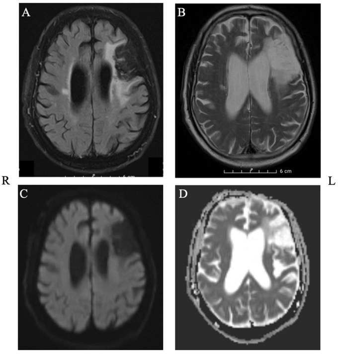 FIGURE 1