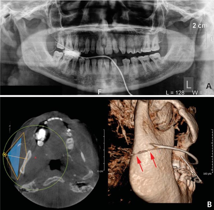 Fig. 2