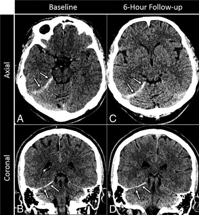 Fig 1.