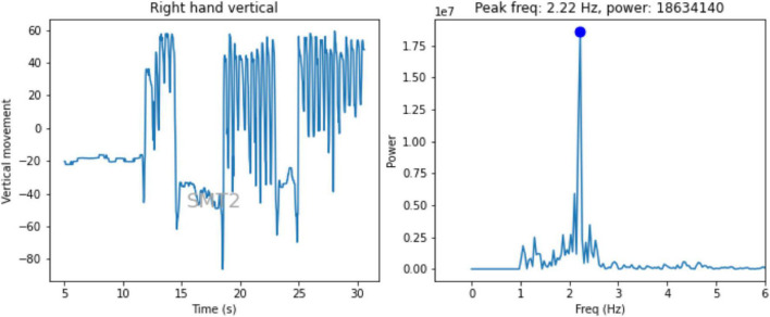 FIGURE 3