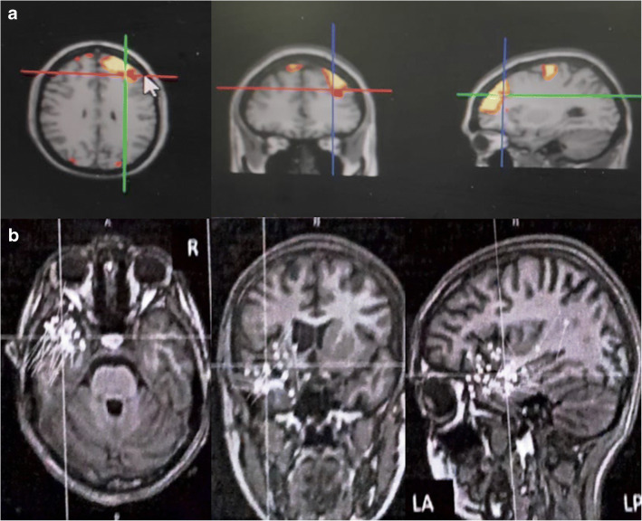 Fig. 3