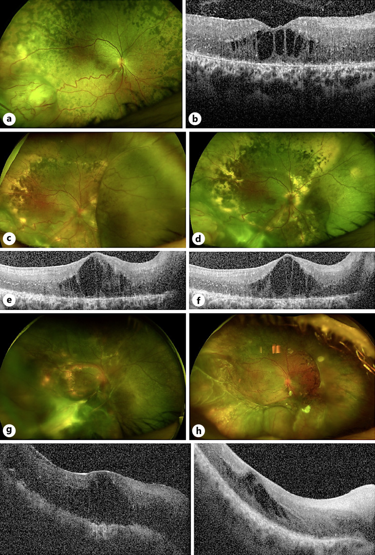 Fig. 4.