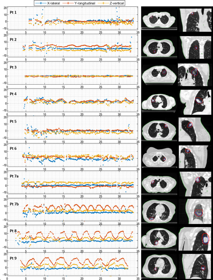 Fig 3