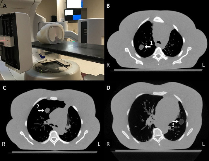 Fig 1