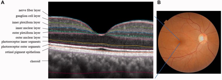 Figure 2