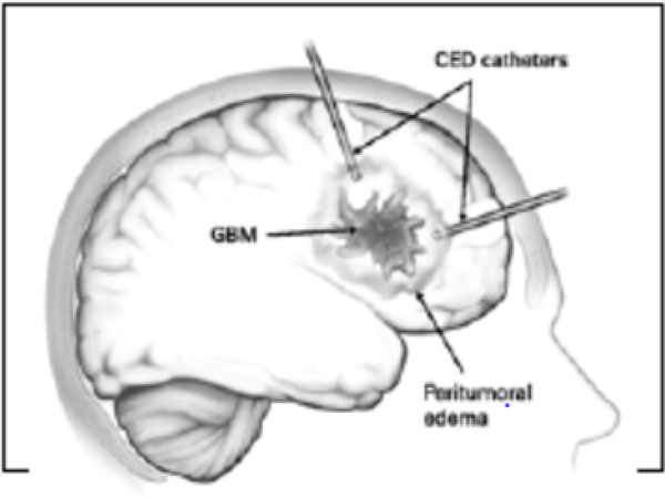 Fig. (1) –