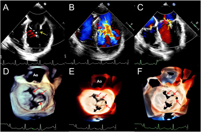 FIGURE 3