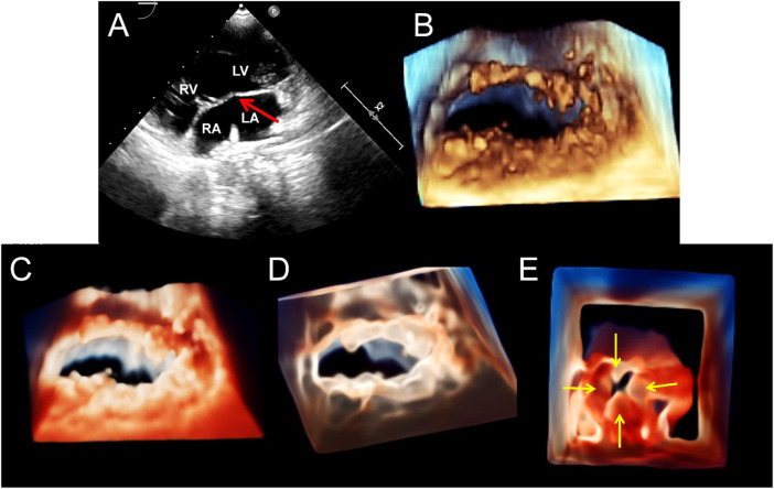 FIGURE 4