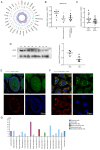 Figure 1. Expression of SIRT5 in human and mouse sperm. (A) Previous proteomics analysis revealed that SIRT5 expression was significantly decreased in asthenozoospermia compared with normal sperm (26)...