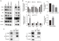Figure 5. SIRT5 regulates the PI3K / AKT signaling pathway in GC–2 spd cells. (A) Western blot analysis of PI3K, p–AKT, AKT, Bcl–2, Bax and SIRT5 in GC–2 spd cells treated with siRNA or lentivirus. (B...