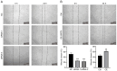 Figure 3. SIRT5 facilitates migration in GC–2 spd cells. (A) Wound healing assay of GC–2 spd cells transfected with SIRT5 (A) siRNA and (B) OE lentivirus. *** P<0.001 vs. NC; ## P<0.01 vs. Ctrl. SIRT5...