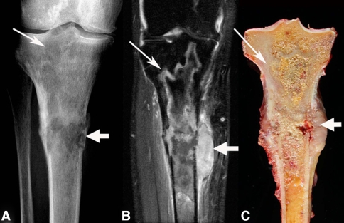 Fig. 1A–C