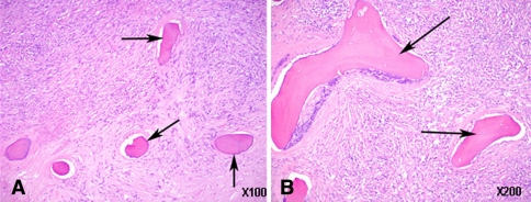 Fig. 2A–B