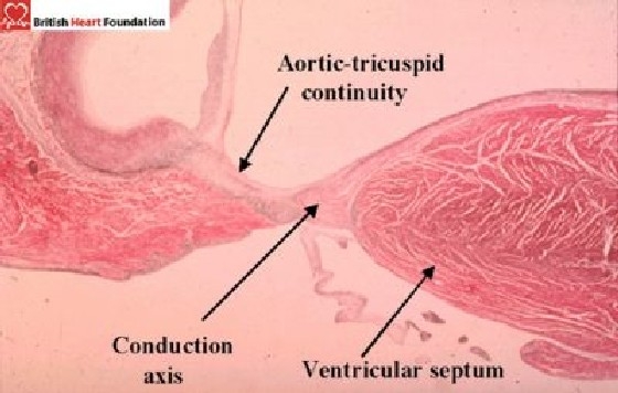 Figure 16