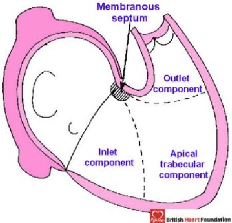 Figure 17