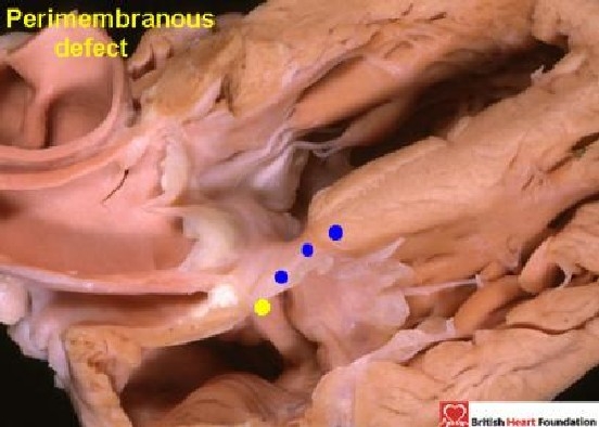 Figure 22