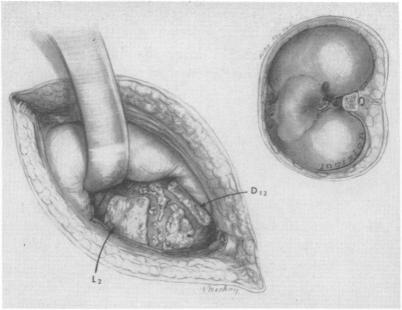 Fig. 14.