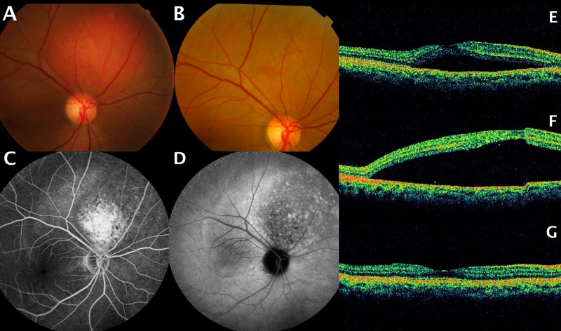 Fig 2