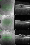 Fig. 3
