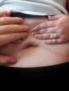 Fig. 4