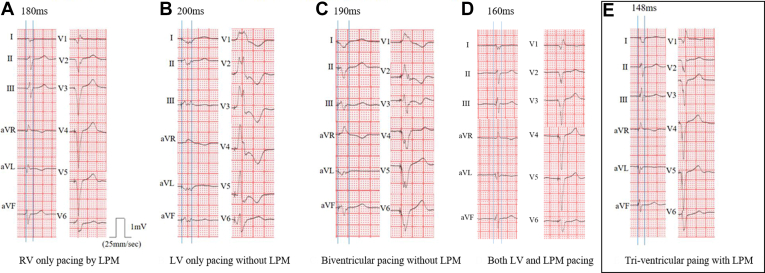 Figure 2