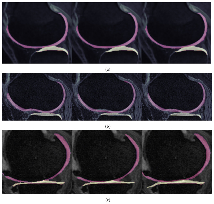 Figure 18