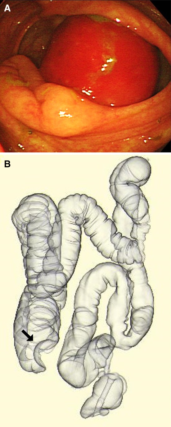 Fig. 2