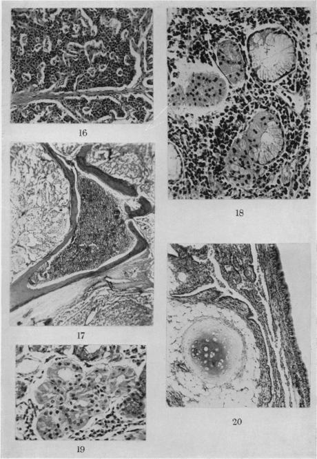 Figs. 16-20