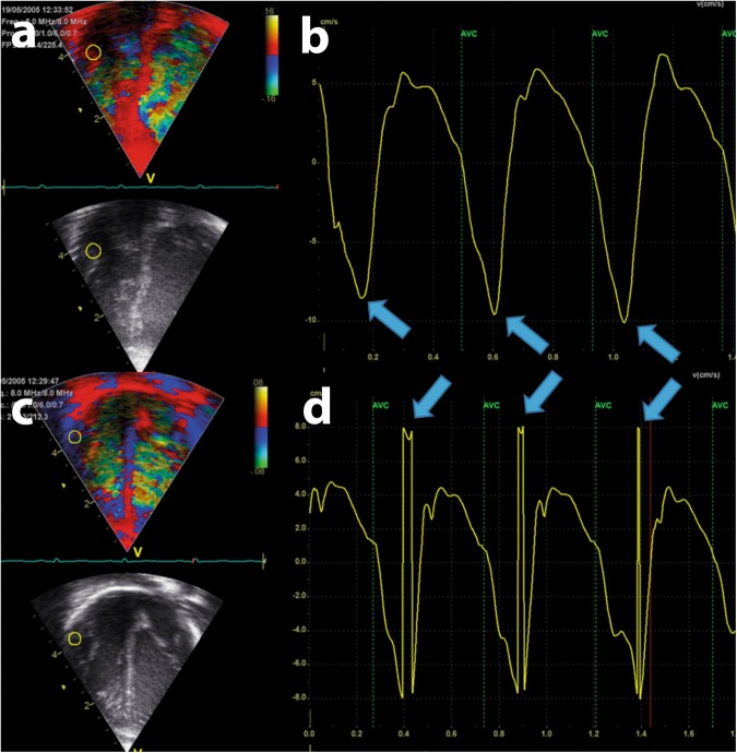 Fig. 4