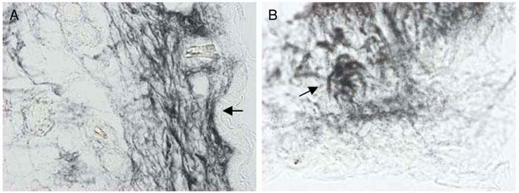 FIG. 6