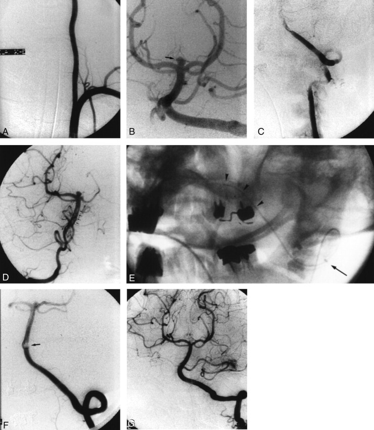 Fig 2.