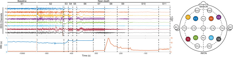 Fig. 1.