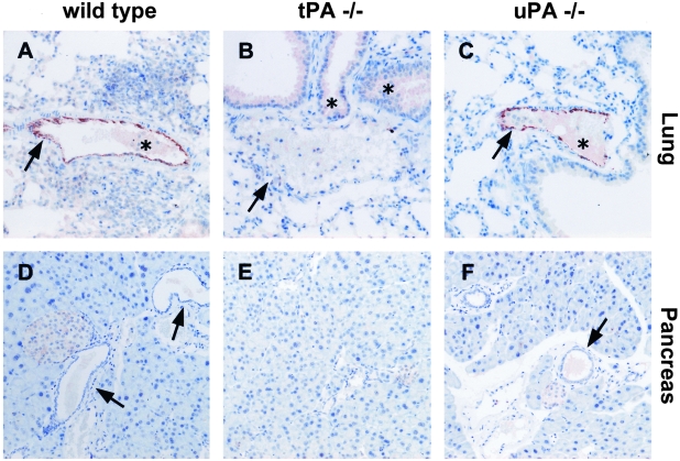 Figure 1-4244