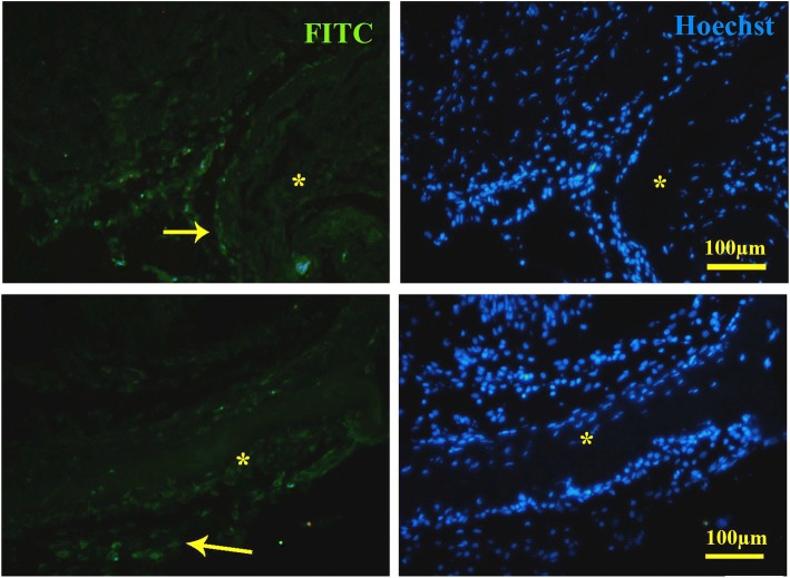 Fig. 14