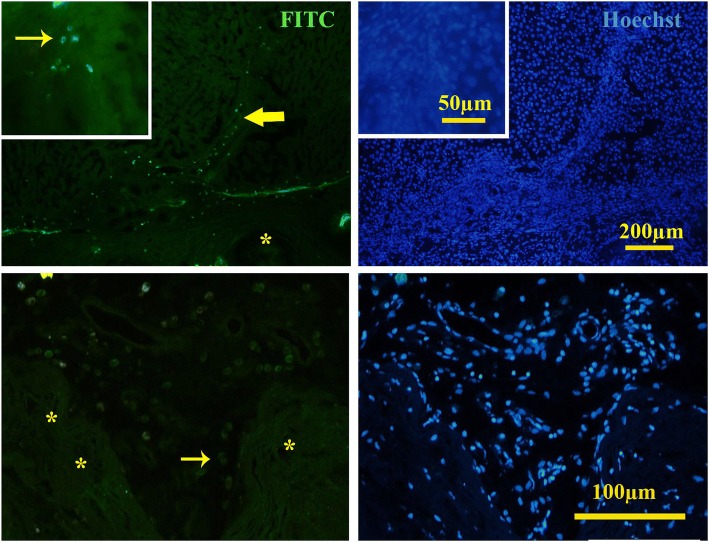 Fig. 13