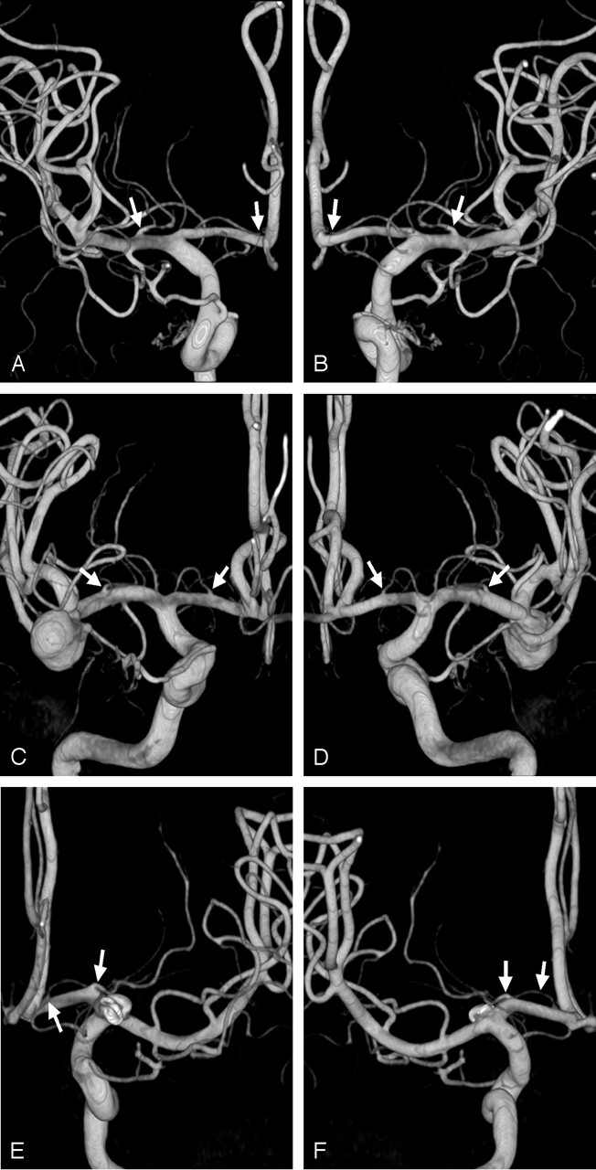 Fig 4.